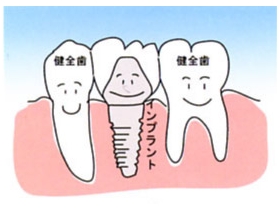 歯が中間で1本抜けた場合